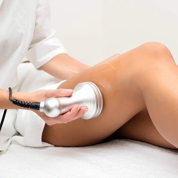 Laser Hair Removal Treatment
