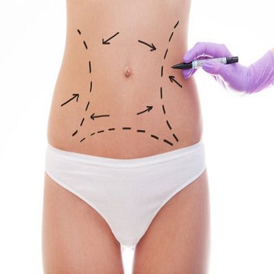Lipo Abdominoplasty in Riyadh for Natural Body Results