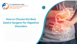 How to Choose the Best Gastro Surgeon for Digestive Disorders
