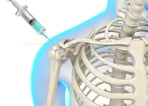 Understanding Shoulder Preservation with Ortho Tools